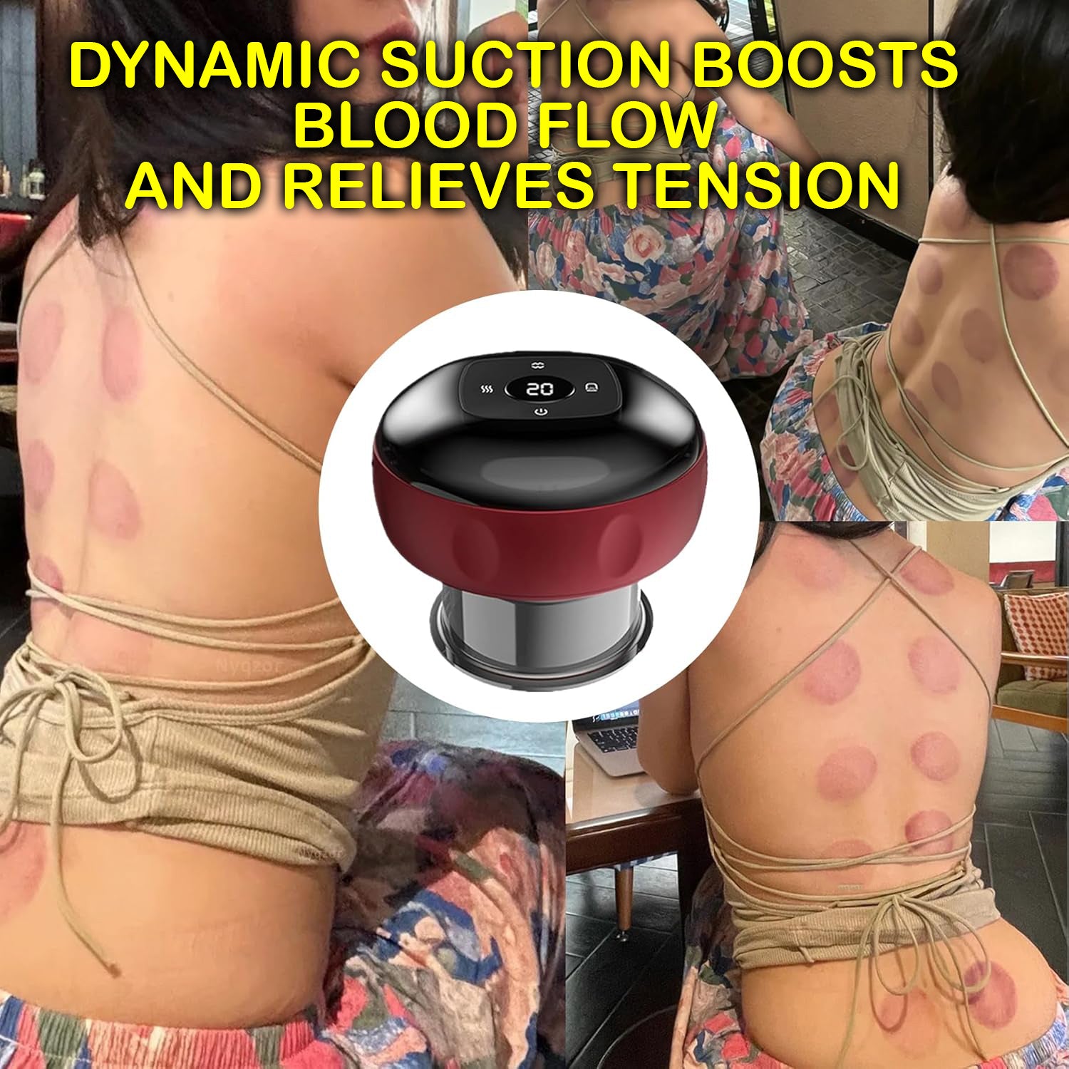 Smart Dynamic Cupping Therapy Set