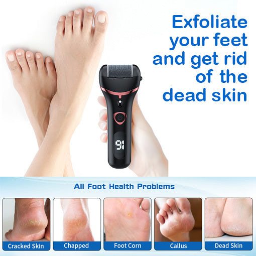 Electric Foot Callus Remover