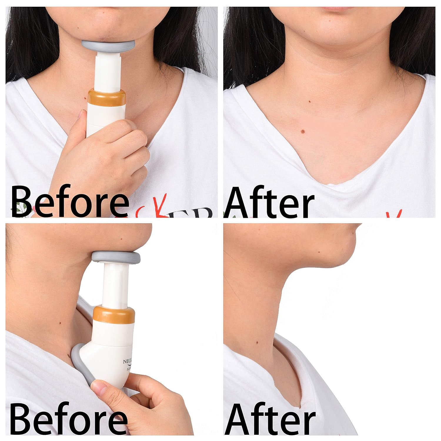 Neckline Slimmer